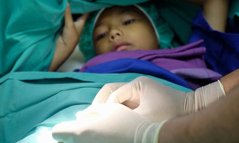 Cắt bao quy đầu