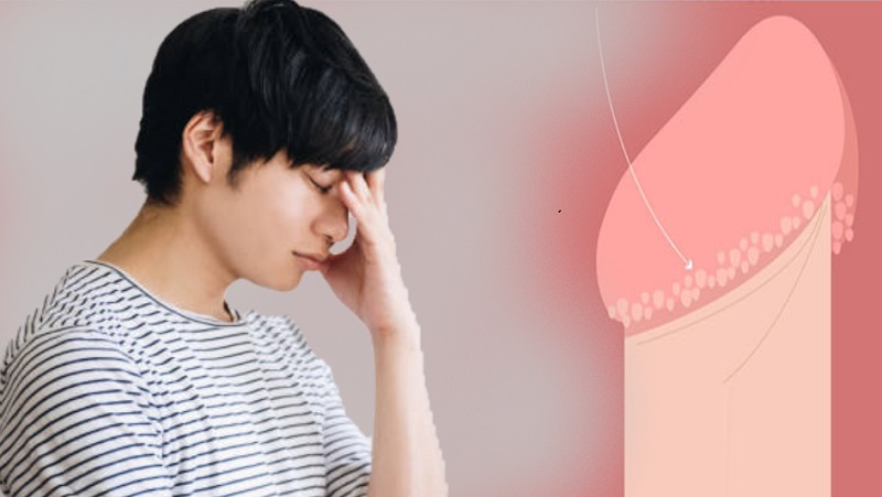 Chuỗi hạt ngọc