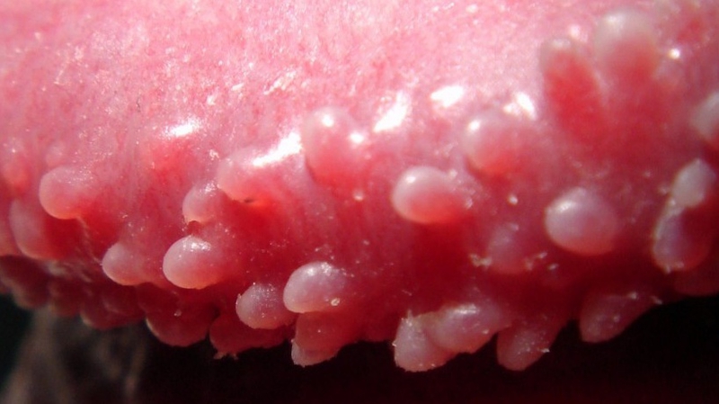 Chuỗi hạt ngọc