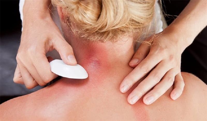 Khi cảm mạo, cạo gió sẽ giúp giảm đi các triệu chứng