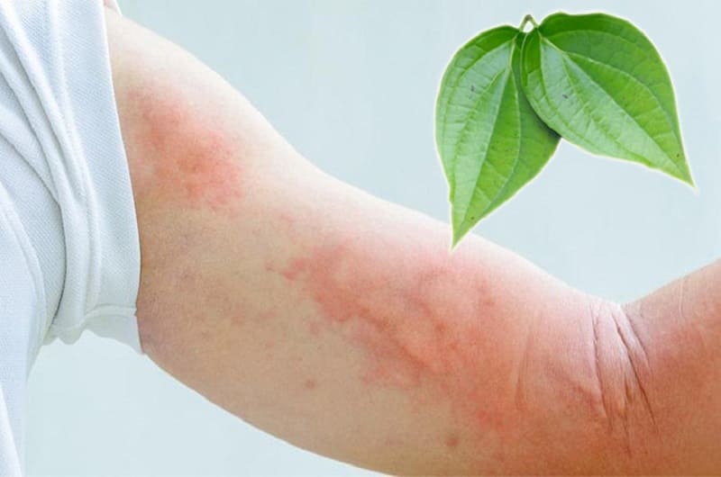 Lá trầu không rất tốt trong việc kháng khuẩn